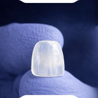 Zirconium or E-max?<br/> The Right Choice Guide for Crowns